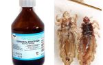 Hydrogen peroxide from lice and nits