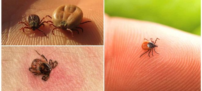 What to do when a tick bite