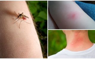 What is the difference between a mosquito bite and a bug or tick bite?