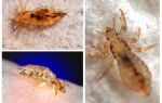 How to get rid of bed lice at home
