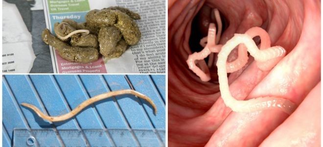 What do roundworms look like in human feces?