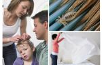 What are head lice afraid of?