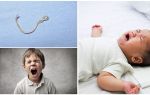 Symptoms and treatment of ascariasis in children