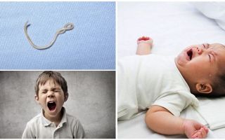 Symptoms and treatment of ascariasis in children