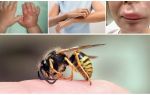 First aid for a child with a wasp sting at home