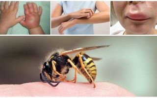 First aid for a child with a wasp sting at home