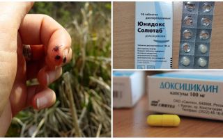 How to take doxycycline with a tick bite