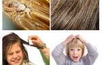 What to do if a child has lice