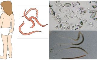 What are pinworms and how they look