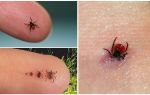 How to get a tick from a person at home