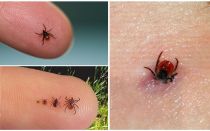 How to get a tick from a person at home