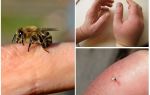 What is useful bee sting for a person?