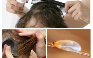How to comb nits