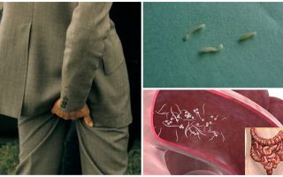 Treatment of pinworms folk remedies