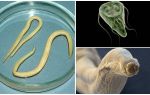 Comparison of Giardia and Worms