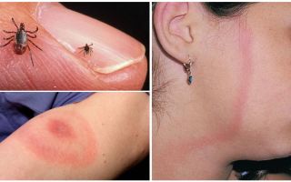 Tick-borne borreliosis symptoms, effects and prevention in adults