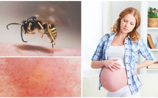 What to do if a wasp is bitten by a pregnant or breastfeeding woman