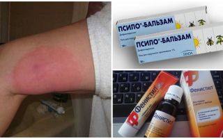 What to do if after a mosquito bite leg swelled