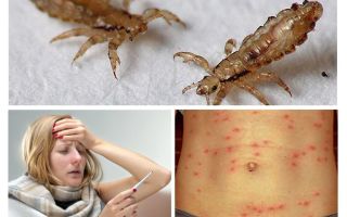 What diseases carry lice