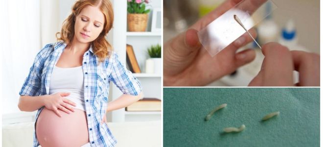 How to treat pinworms in pregnant women