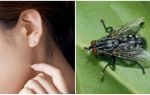 How to get a fly out of your ear at home