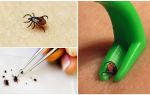 Where in Moscow to hand over a tick for analysis and where to turn if bitten by a tick