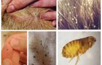 Are fleas transmitted from dog to man