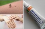 Hydrocortisone ointment for mosquito bites