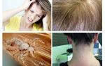 Why does it itch the head after removing the lice
