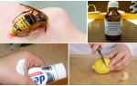 How and how to relieve the itch of a wasp sting at home