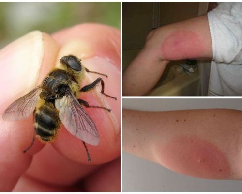 What if the gadfly bite is swollen and reddened
