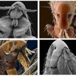 Flea under the microscope