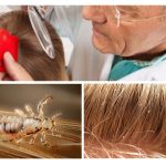 Examination of hair for pediculosis