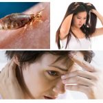 Stress and lice