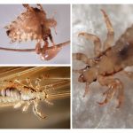 Types of lice