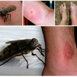 Insect bite on human body