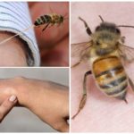 The benefits of bee sting