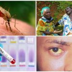 Zika, West Nile and Yellow Fever viruses