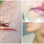 Malaria and tularemia for mosquitoes