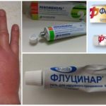 Ointment with mosquito bite