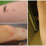 Mossegada de mossegada de mosquits