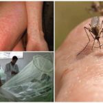 Dengue and Chikungunya mosquito fever