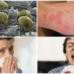 Allergy to bed mites