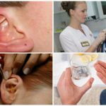 Comprehensive treatment of ear mites