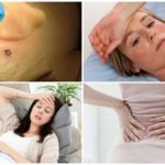 Symptoms of tick-borne encephalitis