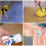 Folk remedies for insect bites