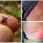 The consequences of elk fly bite in humans