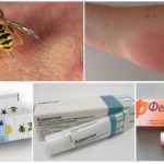 Antiallergic ointment for wasp sting