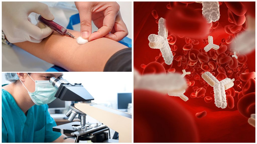 Krevní test na protilátky proti Giardia