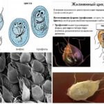 Forms and life cycle Giardia